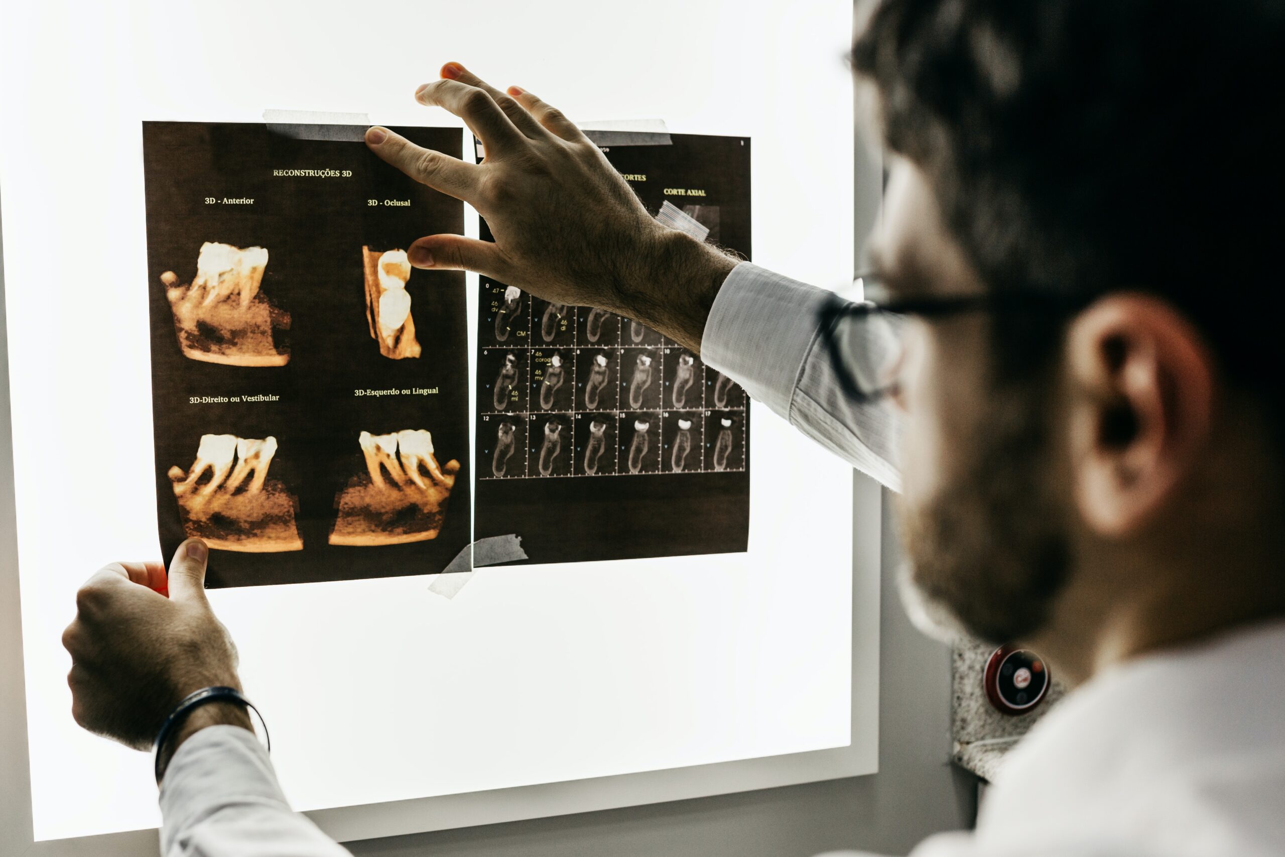 dental implant dentist looking at digital x-rays